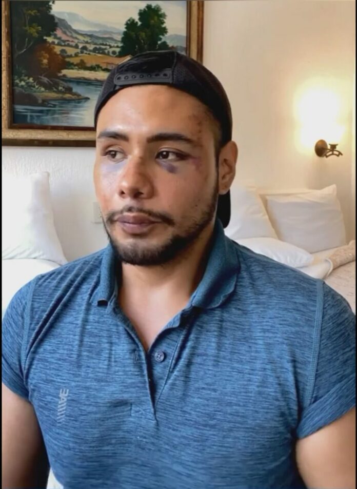 Young man from Vallarta is beaten